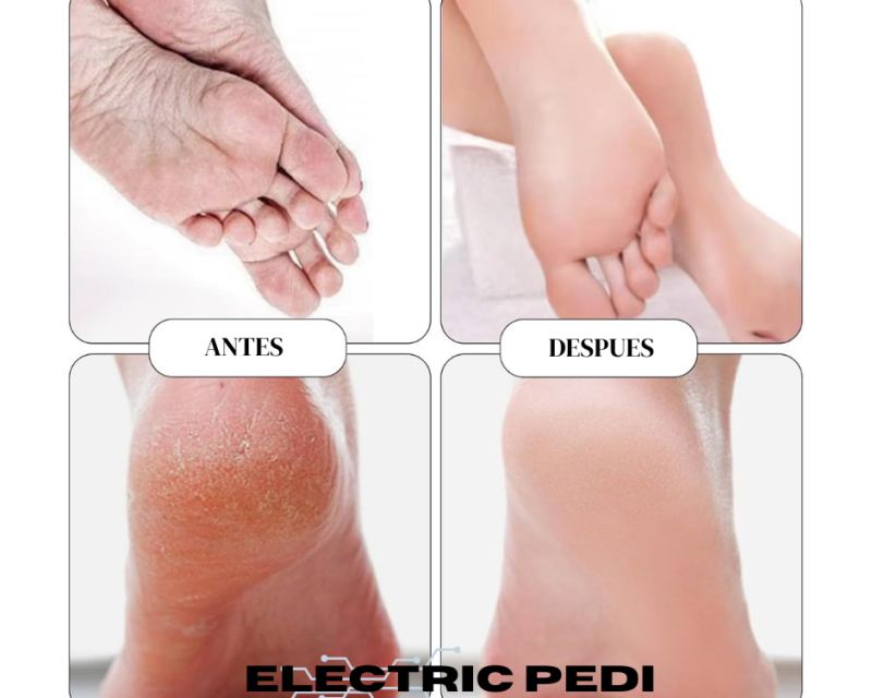 Eliminador de Callos - Máquina de Pedicure - Promo 2x1